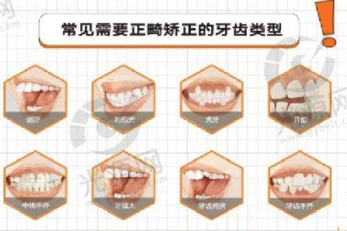成人牙齿矫正的现状