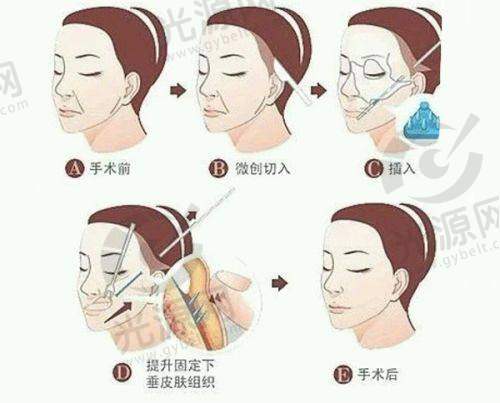 深圳今喜医疗美容门诊部顾客的口碑评价