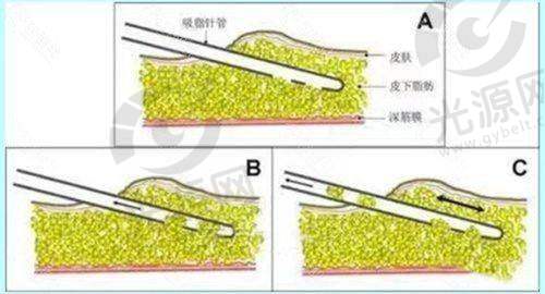 北京丰联丽格医疗美容门诊部开展项目