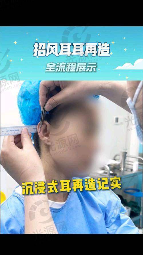 招风耳整形前后图价格范围