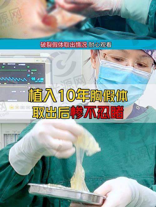 二、长沙湘雅医院擅长的项目技术优势