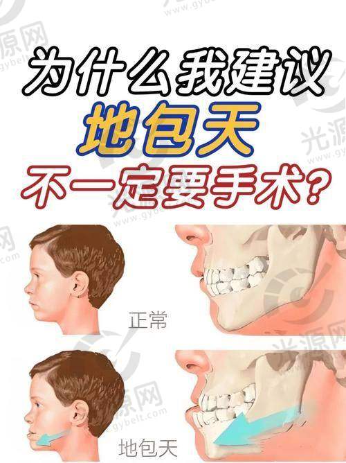 我做地包天手术后悔了：痛苦的修复过程