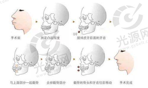 深圳非凡医疗美容医院特色项目