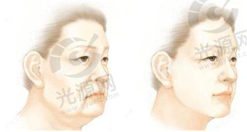深圳非凡医疗美容医院免费停车场相关信息
