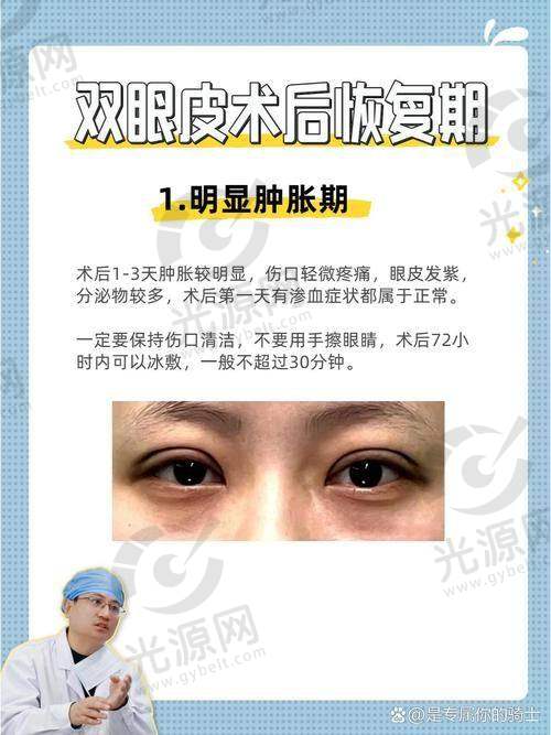 总结双眼皮6 7 8毫米成效图给我们的启示