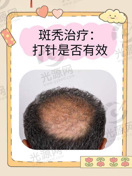 关于何首乌的科学分析