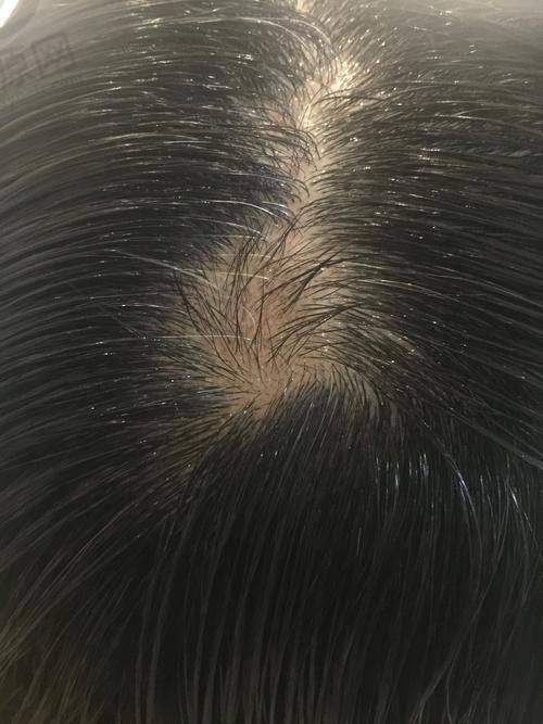 用户反馈与实际实例分析