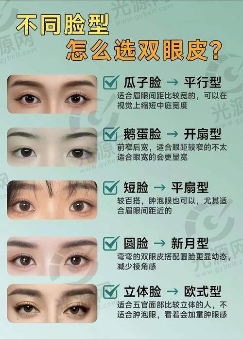魏志香双眼皮修复技术解析