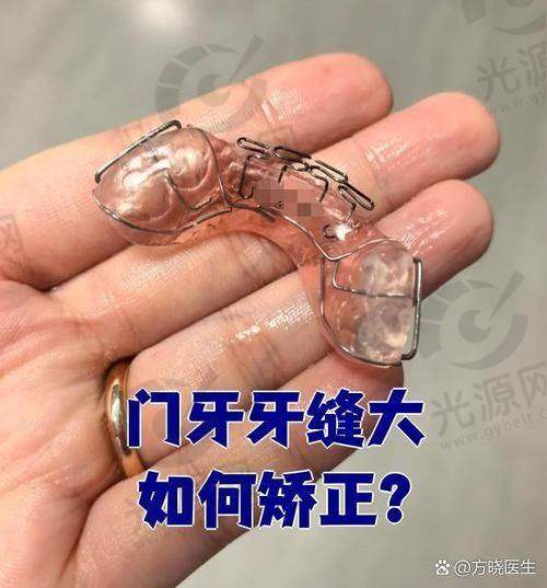 一、南京美奥口腔医院牙齿矫正更重要的是什么