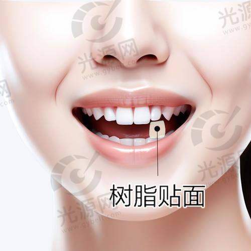 适应症的不同