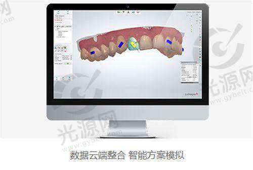 美格真种植体区别