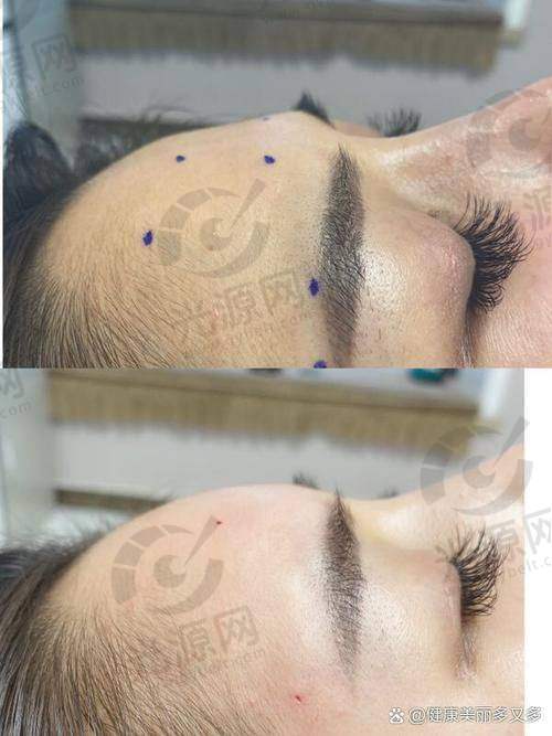 扁头变圆头成功的结论与呼吁