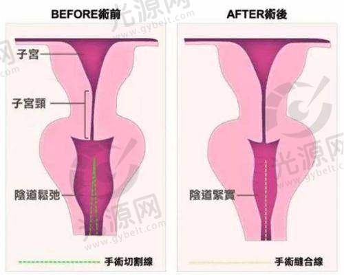 上海联合丽格医疗美容医院预约方式