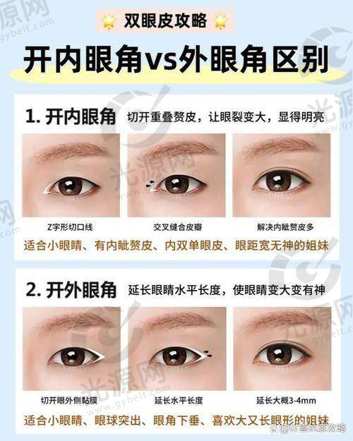 开外眼角后悔了，未来该如何面对？