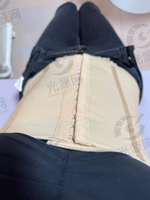 抽脂第一天确实会肿胀