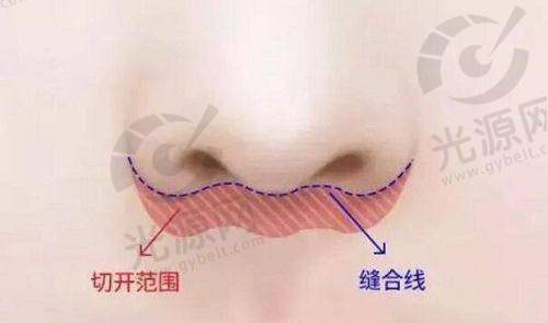 心理上的冲击与失落