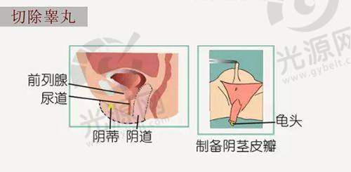 赵烨德医生实例分析