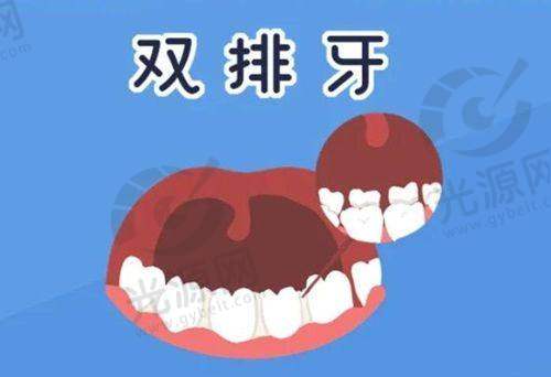 4、南京爱尔口腔种植牙价格表