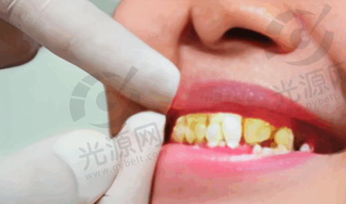 杭州罗强口腔(宝龙门诊部)的设备情况