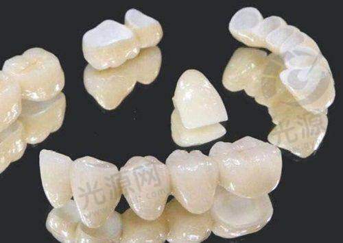 三、昆明柏德口腔医院口碑如何不妨来看集美们的实例评价