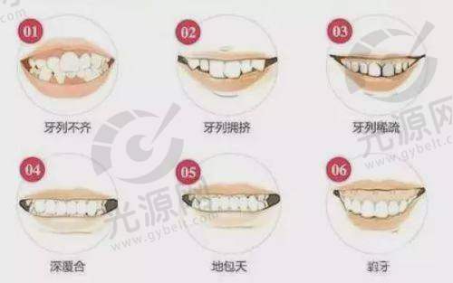 4. 张家口悦己齿科:全方面口腔健康服务