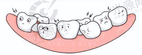 牙龈癌的乳头状突出特征