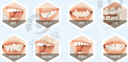 义获嘉全瓷贴面的适用范围