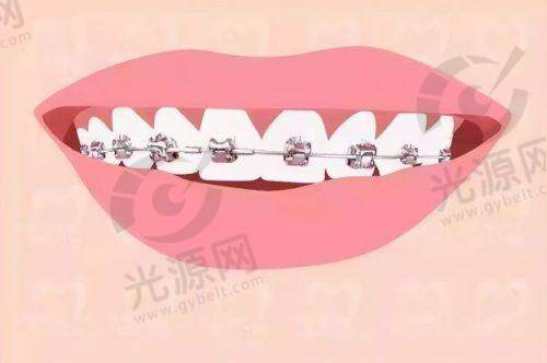 三、北京维乐口腔医院患者口碑如何？实例分享