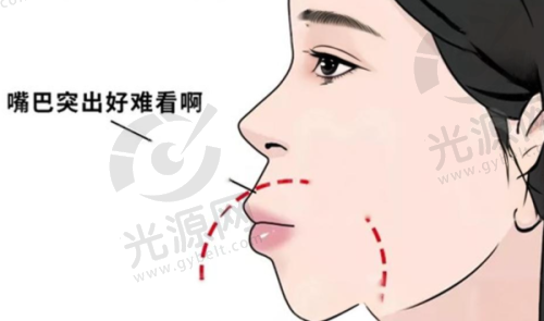 8号牙打牙桩后的护理