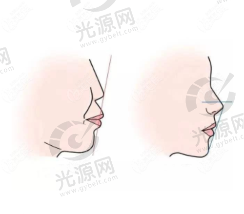 医生技术与经验：4000元的种植牙可靠吗？