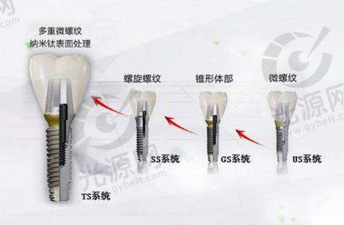 3. 琼海美丽牙医中 心 - 美学牙科的优选