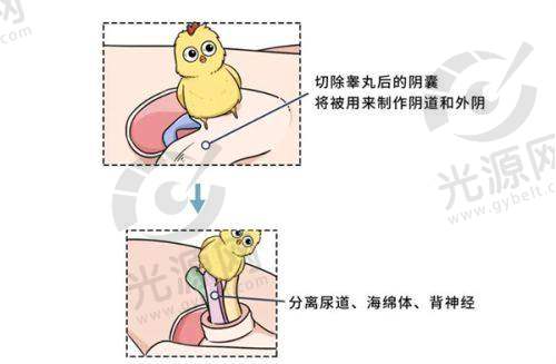 赵烨德医生的收费情况