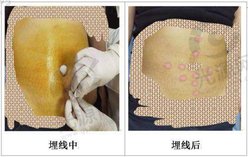 线提升品牌排行榜前十名