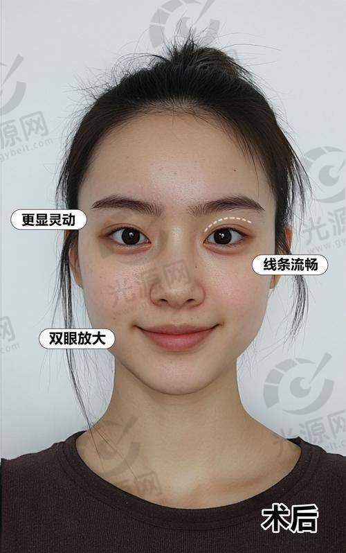 三、重庆西 南医院美容整形科的真实实例分享