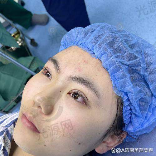 武汉壹加医疗美容医院割双眼皮效果如何？专业团队与先进技术保证满意结果