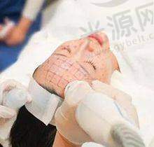 热玛吉面部能量发数的选择