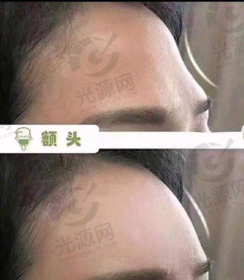 正确理解经常侧身睡的影响