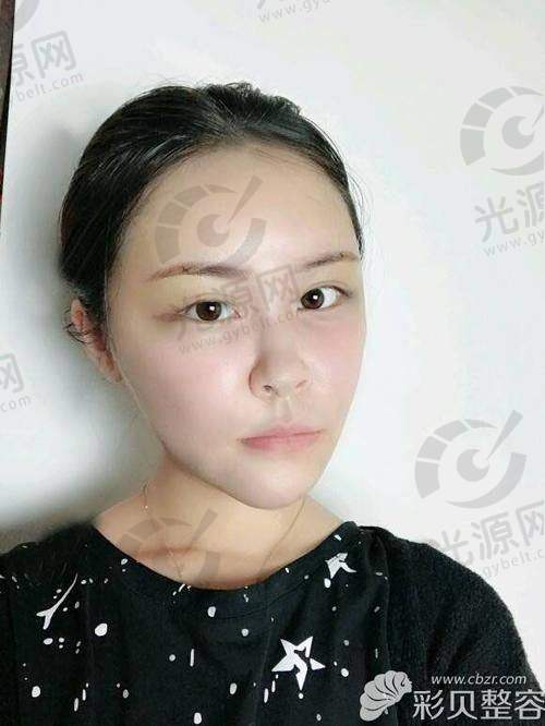 经常侧身睡扁头的解决方案