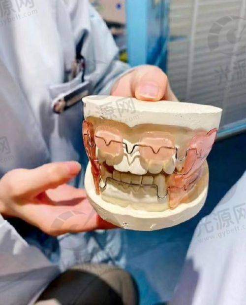 地包天的与对刃颌的关系