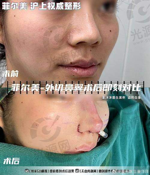 肖志波医生在除皱领域的成就与评价
