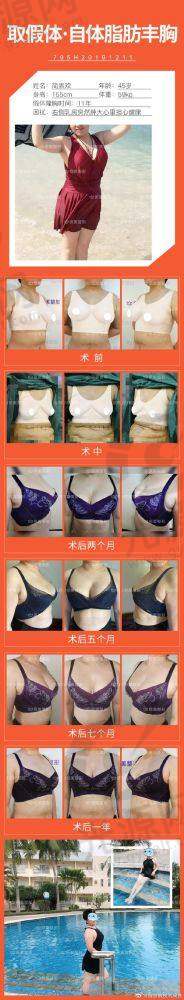 东岳假体的未来展望