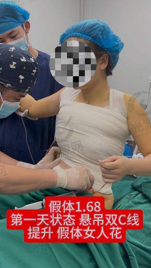 东岳假体的核心技术优势