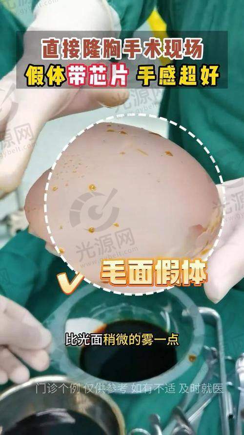 东岳假体的品牌来源