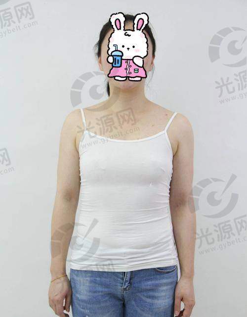 东岳假体的市场表现