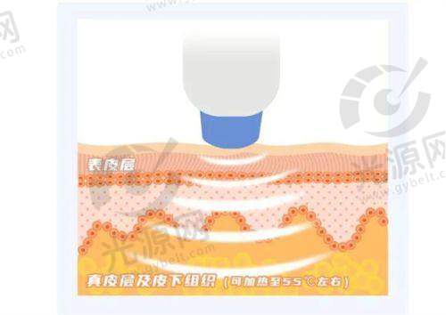 后期护理与维持成效