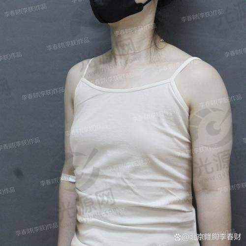 影响傲若拉毛面假体价格的因素