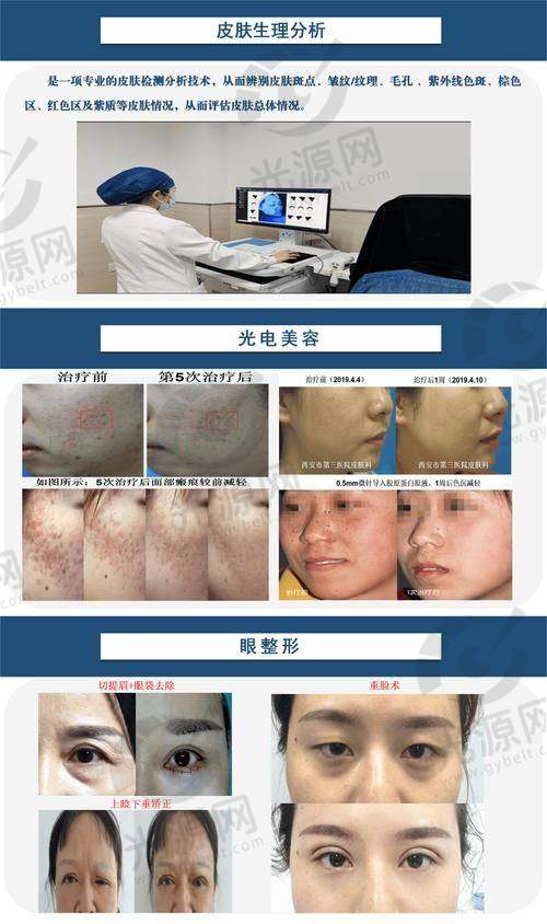 美拉提的作用深度解析
