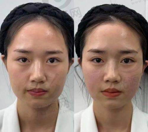 温度与时间的配合对成效的影响