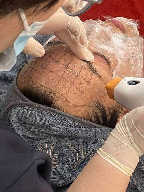 实例分享：热玛吉成功实例