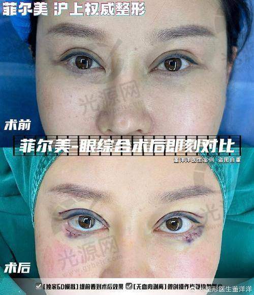 10. 南宁熠美整形医院：专精的定制化整形体验
